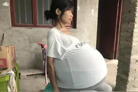 女子肚子2年疯长成40斤巨球 只能坐着睡觉，至今原因不明图片