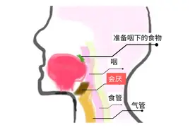 突然“嗓子痛”，35岁男子险因它丧命！有这2种症状速就医图片