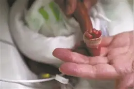 医护连续116天接力救治，不足一斤早产儿奇迹存活图片
