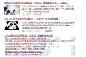 大学生连续熬夜竟然长出了“毛尾巴”！专家：这种病多见于18岁至40岁男性图片