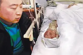 被狗咬了要打疫苗，那被人咬了该怎么办？图片