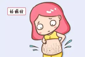 恼人的妊娠纹！如何让它慢点长、少长点图片