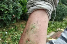 修剪花树时误“捅”马蜂窝，绿化工被群蜂追赶吓坏了图片