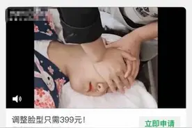 徒手捏捏拥有明星同款小V脸？火遍社交网络的小颜整骨到底靠谱吗？图片