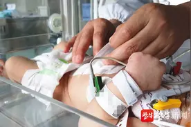 新生儿肚脐“冒泡泡”，这是患上了一种病图片