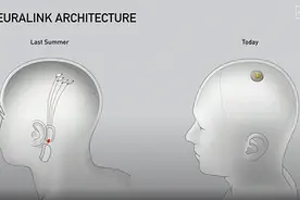 马斯克发布脑机接口重大突破：蓝牙连接，一小时植入，人体实验在即图片