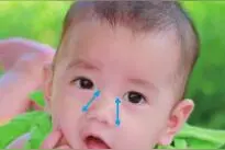 腺样体切除后宝宝身体“虚上加虚”，教你3招调养回来图片
