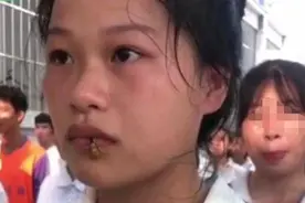看着都害怕！女生军训被马蜂爬嘴一动不动图片