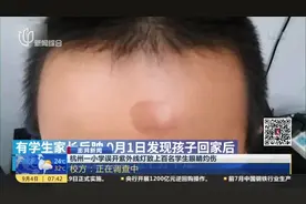澎湃新闻：杭州一小学误开紫外线灯致上百名学生眼睛灼伤视频封面