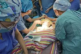 罕见！江西一男婴刚满月，又“生”了一个“宝宝”图片