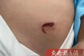 海口一9岁女孩被狗咬伤，家长却只能自认倒霉？图片