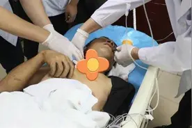 看着就疼，钢筋从工人腋下穿入嘴部穿出，多方合力生死救援图片