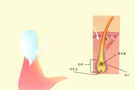 “少白头”是因为黑色素细胞提前合成减少吗？图片
