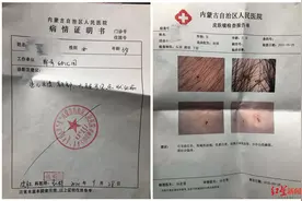 呼和浩特一幼儿园3名老师被刑拘 家长：孩子说老师把他们叫到厕所用针和牙签扎图片
