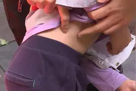 5岁男童被狗咬伤父母索赔，狗主人称像蚊子叮了一个小洞图片