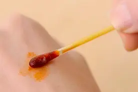 常用皮肤消毒剂知多少?图片