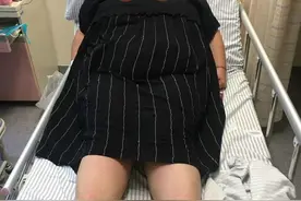 318斤孕妈产子，手术床躺不下！诞下10斤多大胖仔图片