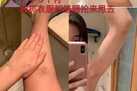 前短跑名将张培萌妻子发长文怒揭婚内伤痛，出警记录、伤情图片令人震惊图片