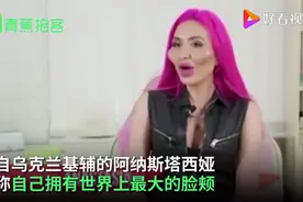 乌克兰网红模特自称拥有世界最大脸颊，网友们看法不一图片