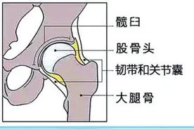 婴儿髋关节筛查不能忽视图片