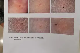 又有幼儿被老师针扎？呼和浩特市警方介入调查，涉事幼儿园无办学资质已关停图片