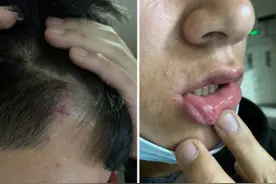 洛阳一体校两名新生因“拒绝捡球”被打 办案民警：系欺凌事件，正调查图片