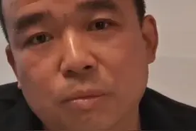 男子跳化粪池救人留后遗症：不后悔，下次还会救人图片