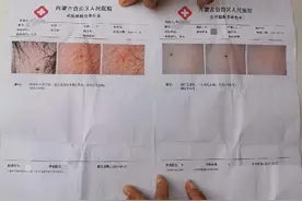 呼和浩特“多名幼儿身上现针眼案”：3涉案教师被捕图片