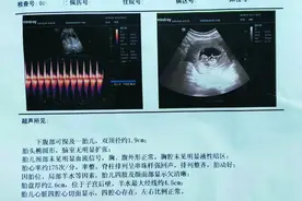 精神病女患者住院期间和男护工“自愿”发生关系怀孕？家属四处讨说法处处“碰壁”图片