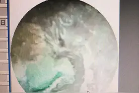 熊孩子耳朵里塞玩具，取出一物还有一物图片