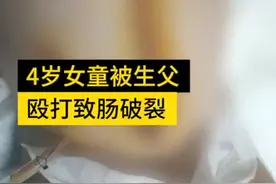 4岁女童遭生父殴打致肠破裂，哭声撕心裂肺，网友怒了图片
