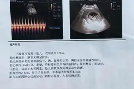 河北女精神病人与护工“自愿”发生关系怀孕 警方：已对护工采取监视居住图片