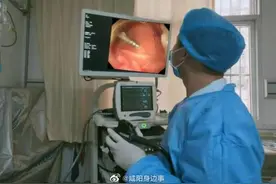 咸阳1岁男孩玩耍时，不慎将铁钉吞入腹中图片