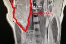 字少情长 这封古诗体感谢信背后是一台长达15小时的接力手术图片