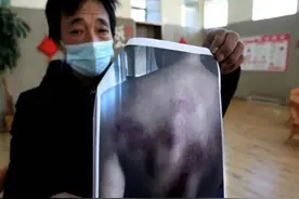 15岁孩子因琐事在学校被殴打，校方回避，教育局回应图片