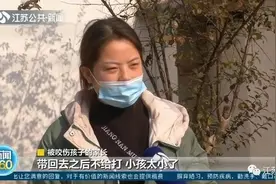 一天3名孩子被咬伤，皮肉几乎被咬穿！带娃去动物园你还敢做这事？图片