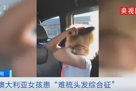 爱因斯坦同款！澳大利亚女孩患“难梳头发综合征”，曾被嘲笑像“手插在了电源里”图片