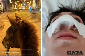 俄罗斯一醉酒男子街头亲吻马 被马咬掉鼻子图片