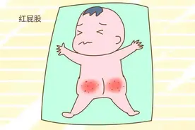 宝宝“红屁股”，小心肛周脓肿（肛瘘）图片