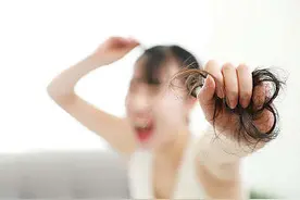 25岁女孩发际线高如寿星公，医生说：女性这样求美易致脱发图片
