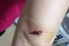 壹点帮办丨济南一女子被突然打开的车门撞倒在地，后续处理成难题图片