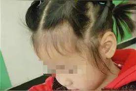 村民锯断杨树砸中3岁女童，医院两次下达病危通知书图片