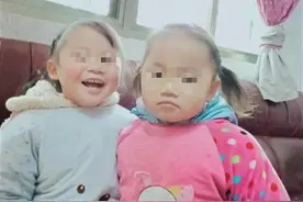 家中失火四岁姐姐将妹妹护在身下，小姐妹双双烧伤盼救助图片