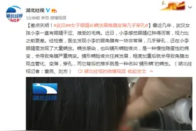 差点失明！武汉女子眼睛长螨虫眼角膜变薄几乎穿孔图片