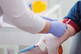 “明明是腿有问题，为什么要看血管外科？”看到结果后，杭州男子慌了神......图片