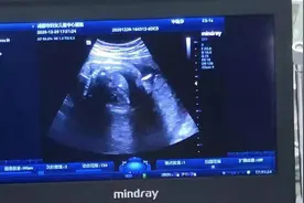 惊险！还没出生的宝宝在“娘胎”里手术图片