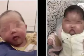婴儿用抑菌霜成大头娃娃？！专家：想要根治得这样做→图片