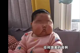 福建一婴儿用抑菌霜后长毛发胖？涉事产品已责令召回图片