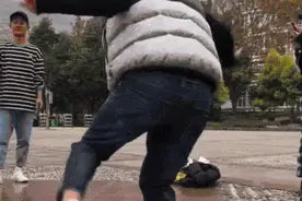 得了这病，半岁宝宝脚趾比香蕉还粗！做手术后，九成以上还可能复发图片