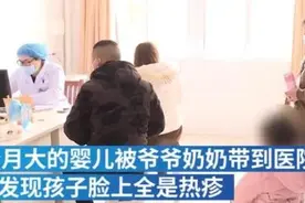 婴儿被老人裹8件衣服患捂热综合征 致高烧40度图片